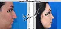 عمل بینی شماره 833