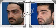 عمل بینی شماره 839