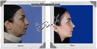 عمل بینی شماره 847
