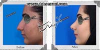 عمل بینی شماره 850