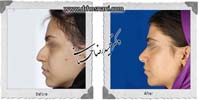 عمل بینی شماره 859