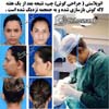 عمل بینی شماره 863