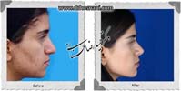 عمل بینی شماره 865