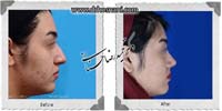 عمل بینی شماره 874