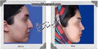 عمل بینی شماره 883