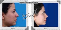 عمل بینی شماره 896