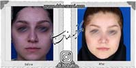 عمل بینی شماره 897