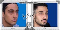 عمل بینی شماره 899
