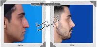 عمل بینی شماره 900