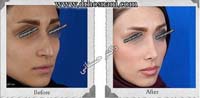 عمل بینی شماره 901