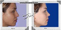 عمل بینی شماره 906