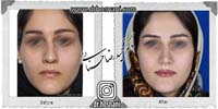 عمل بینی شماره 907