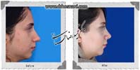 عمل بینی شماره 916