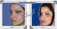 عمل بینی شماره 936