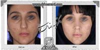 عمل بینی شماره 939