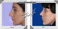 عمل بینی شماره 940