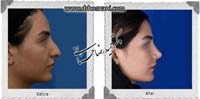 عمل بینی شماره 948