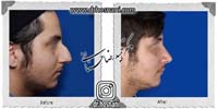 عمل بینی شماره 949