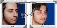 عمل بینی شماره 950