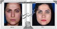 عمل بینی شماره 959