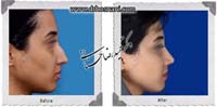 عمل بینی شماره 968
