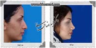 عمل بینی شماره 982