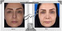 عمل بینی شماره 999
