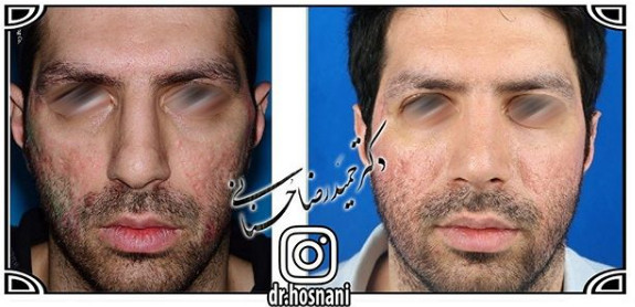  جراحی بینی -1049