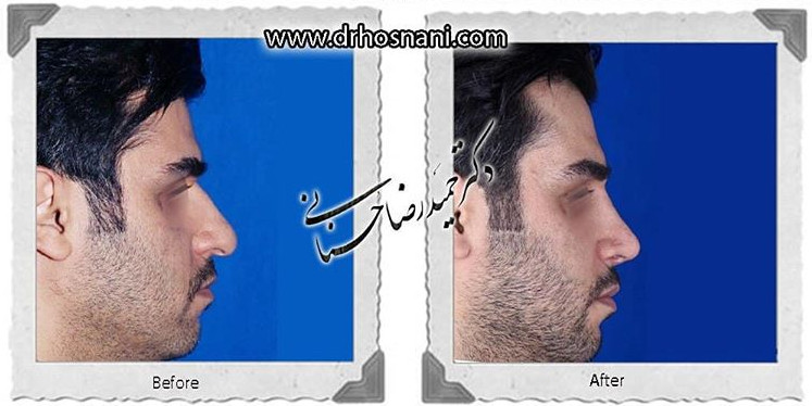  جراحی بینی -783