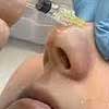 ampule