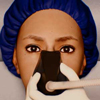 anesthesia