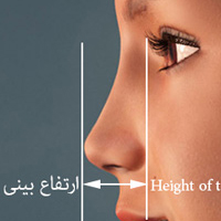 height