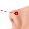laser