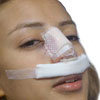 nasal