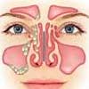sinus