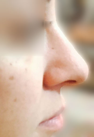 nose 3864