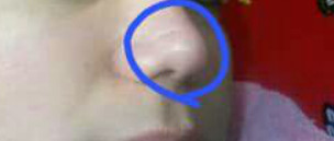 nose 5001  