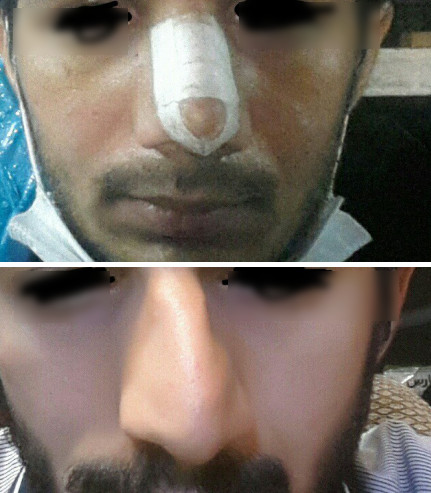 nose 5048  