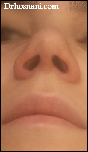 nose 5070  