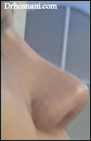 nose 5074  