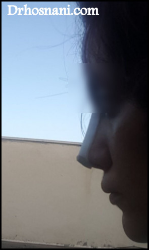 nose 5121  