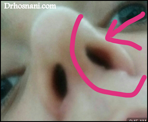 nose 5255  