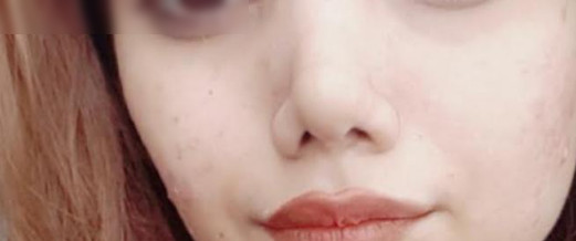 nose 5325  