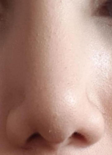 nose 5326  