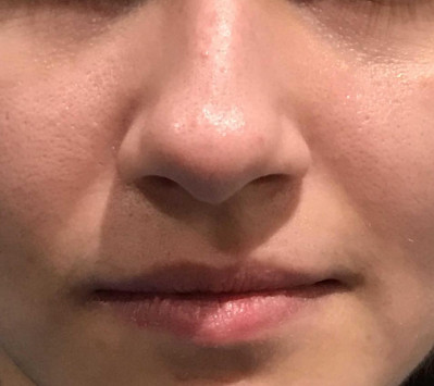 nose 5334  
