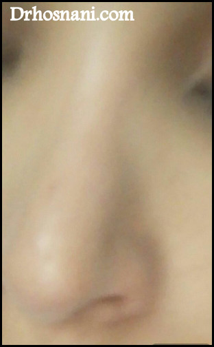 nose 5374  