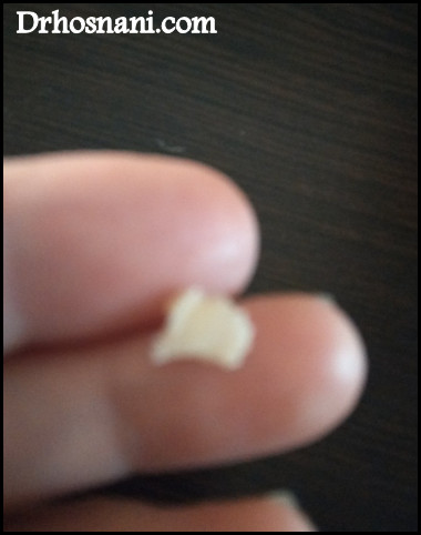 nose 5439  