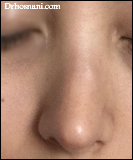nose 5517  