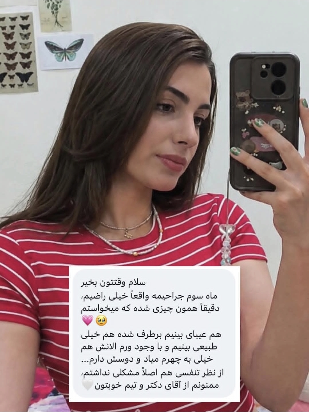 سه ماه بعد از جراحی بینی