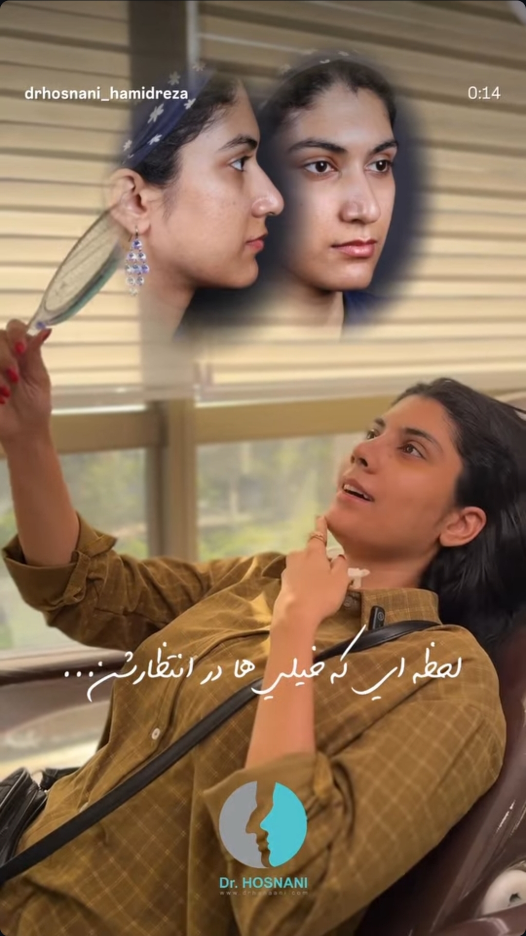 لحظه بعد از برداشتن گچ بینی